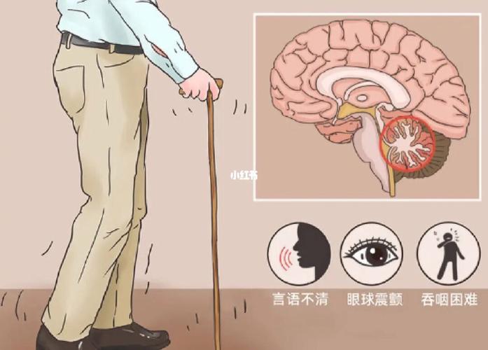 二四六香港资料期期准中特和送小脑萎缩儿子高考与小脑萎缩能上学吗